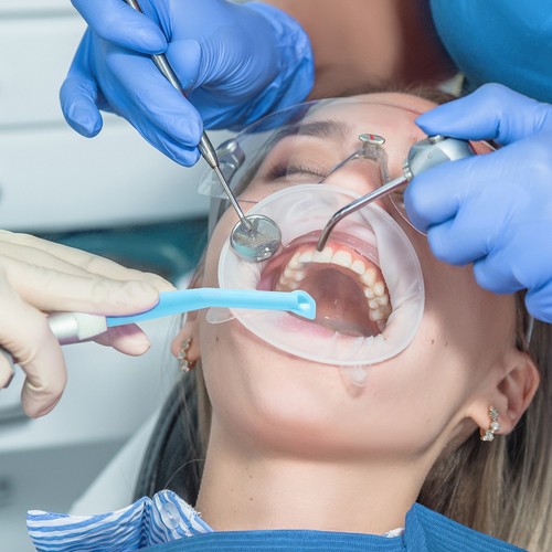 AZDENT Tips de Aspiración Quirúrgica Dental Puntas de Evacuación de Alta Succión - Picture 6 of 24