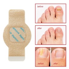 21 Pcs Fungal Nail Patches - Extra Strength Toenail Fungus Treatment Overnight