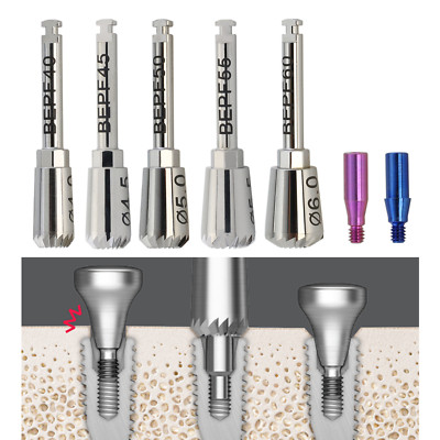 Hiossen OSSTEM Implant Bone Profiler Guide Screws 4.0 5.0 5.5 6.0 MIS Megagen
