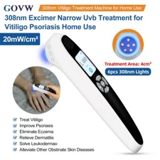 GOVW 20mW/cm² UVB Phototherapy Lamp Device Treatment for Skin Disorders At Home