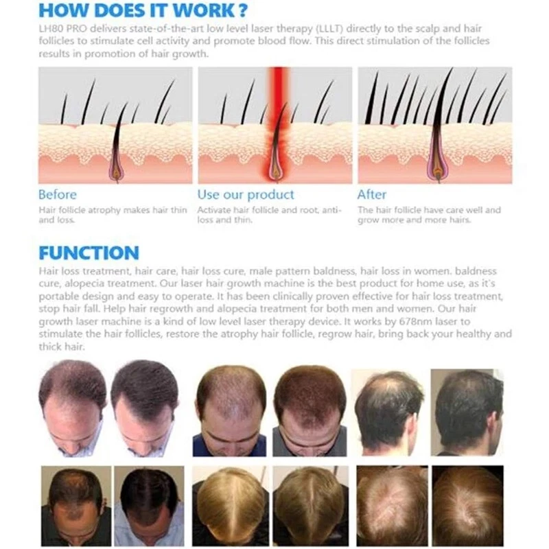 80二极管LED脱发再生生长治疗帽头盔治疗脱发 — 第 3/4 张图片