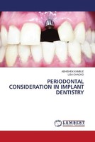 Abhishek Kamble (U. A.) | Periodontal Consideration IN Implant Dentistry | Buch