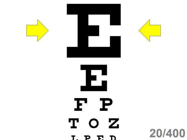 Ophthalmic Optometric Computerized Visual Acuity Software - Excellent Value - Image 2 of 4