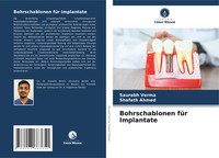 Saurabh Verma (U. A.) | Bohrschablonen FüR Implantate | Taschenbuch | Deutsch