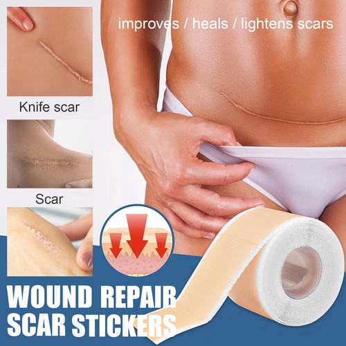 Skin Repair Patch Aufhellung Unreinheiten sanfter Inhaltsstoff tägliche Pflege Reparaturpflaster - Bild 3 von 5