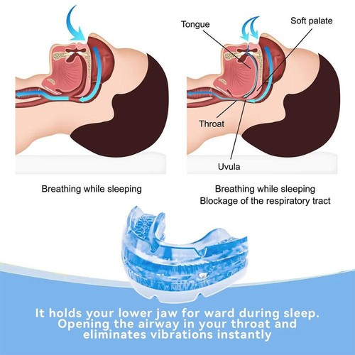 Anti Snore Mouth Guard Sleep Better Anti Snoring Devices with Storage Hot Sale - Picture 9 of 14