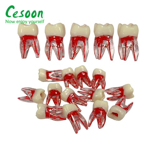 50 piezas modelo de estudio de conducto radicular endo dental ECA bloques de práctica cavidad pulpar - Imagen 6 de 14