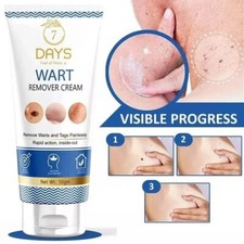7 Days Genital Wart Removal Cream on Face, Neck, Forehead  Cheeks 50gm Pack