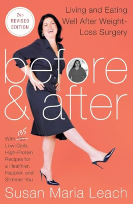 Before & After: Living and Eating Well After Weight-los - Paperback NEW Susan Ma
