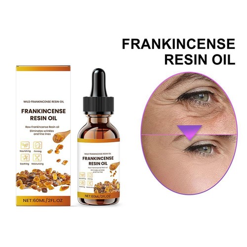 Organic Frankincense Resin Facial Oil - Reduces Fine Lines US 60ml P1O7