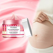 Pregnancy Belly Stretch Mark Cream 100g Body Moisturizer caffeine arnica Dry AU