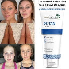 7 DAYS Natural De-Tan Cream with Kojic For Tan Free & Smooth Glowing Skin 100gm