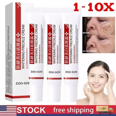 1-10X Face Roller Skin Care Spot Off Freckle Whitening Cream Effective Whitening
