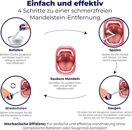 Oravix Mandelsteine Schröpfglas, Mandelsteine Entfernen Sauger, Mundgeruch Bekäm - Bild 7 von 8