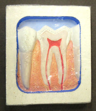 vintage #9 McKesson Robbins DISPLAY TOOTH Dentist study aid dental dentistry z5