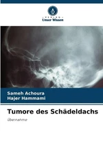 Tumore des Schdeldachs by Sameh Achoura Paperback Book