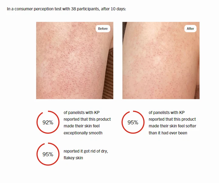 6X First Aid Beauty FAB Bump Eraser Exfoliating Body Scrub w/10% AHA 1.0oz Each - Image 3 of 4