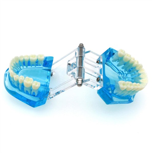 Multiple Types Dental Teeth Model Ortho Implant Practice Teaching Demo Model - Picture 227 of 276