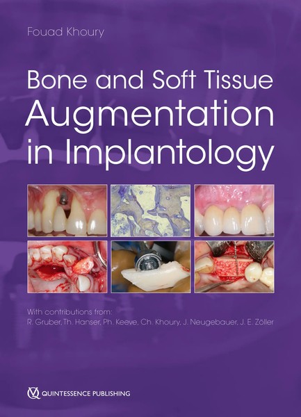 Bone And Soft Tissue Augmentation In Implantology | Englisch | Buch | 768 S.-image