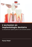 L'occlusion En Implantologie Dentaire Faraz Patel Taschenbuch FranzöSisch 2023