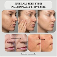 Exfoliating Face Peel Gel - Gentle Dead Skin Removal