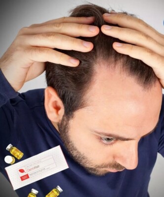 Derm Hair Mesotherapy Dermclar Dermhair Perdida Cabello Mesoterapia
