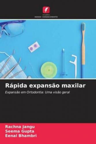 Thumbnail - Rápida Expansão Maxilar Expansão Em Ortodontia: Uma Visão Geral 6666