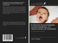 Aamir Al Mosawi | El SíNdrome De Anormalidades Oculares AsiméTricas, Y El...