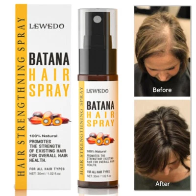 LEWEDO Batana Oil Serum Hair Growth Spray Anti Hair Loss Fast Regrowth Scalp Treatment