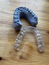 Dual Laminated Night Guard for Teeth Grinding and Jaw Clenching