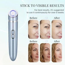 Multifunction Led Intelligent Eye Care Dark Circles Remove Machine Eye Massager