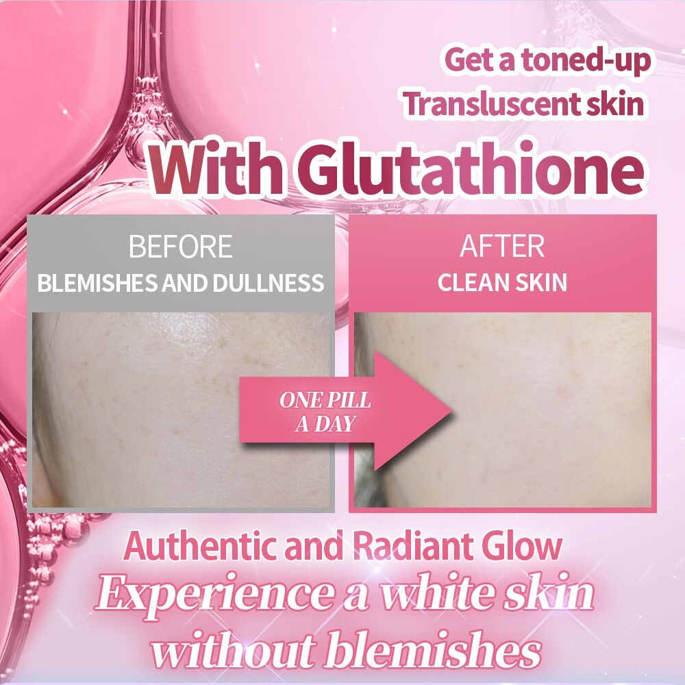 Slimplanet] Korea Best Whitening Supplement Glutathione