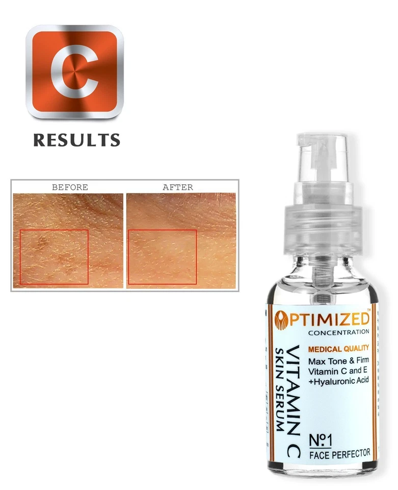 #1 BEST Anti Aging Vitamin C Serum with Vitamin E and Hyaluronic Acid - Image 3 of 4