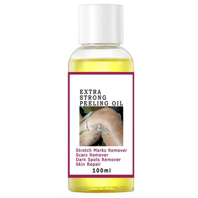 Starke gelbe Peeling-Öl-Peelinglösung für Gesicht, Körper, dunkle Haut, Knö