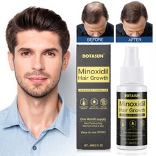 Minoxidil 5 Hair Regrowth Treatment Topical Solution for Men 1 Month Supply