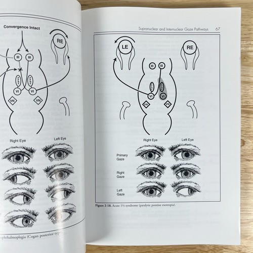 Neuro-Ophthamology Review Manual 7th Edition by Lanning Kline, Foroozan 2013 PB - Picture 7 of 9
