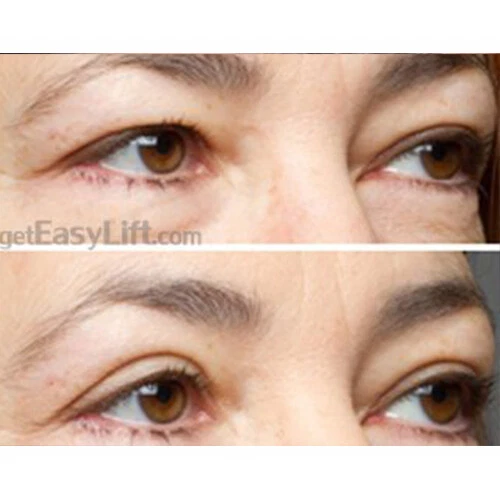 Lifting de ojos instantáneo Easy Lift Foto 4 de 4