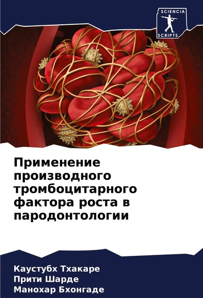Primenenie Proizwodnogo Trombocitarnogo Faktora Rosta W Parodontologii Buch 2024-image