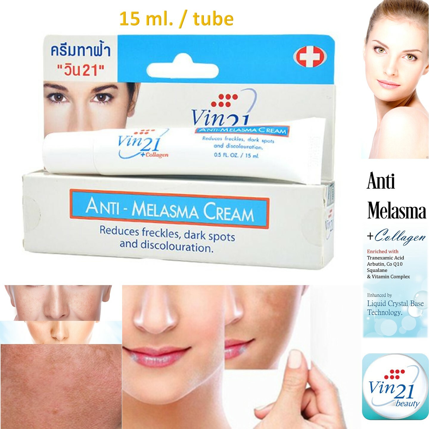 melasma cream watson
