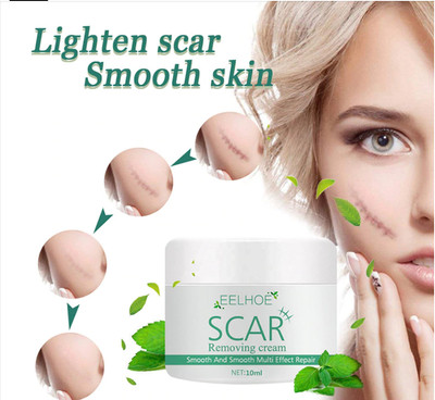 stretch mark cream on face