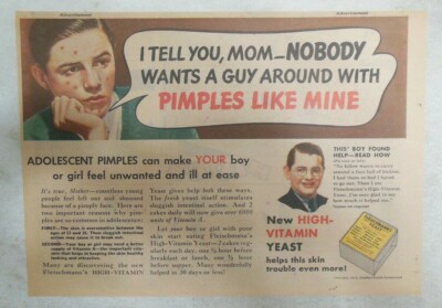 Fleischmann's Yeast Ad: Nobody Wants a Guy With Pimples Like Mine ! from1930's