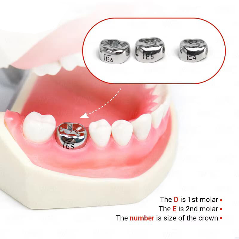 5-Piece Dental Molar Crown Set - Stainless Steel Preformed Adult Crowns - All Sizes 4 thumbnail image