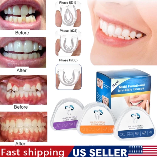 3-Stage Adult Teeth Aligners Orthodontic Braces Trainer for Dental Alignment