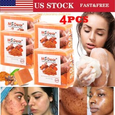 4PCS Tumeric Soap Skin Whitening Dark Spots lightening Acne Brightening Turmeric