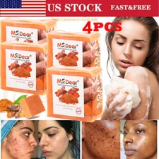 4PCS Tumeric Soap Skin Whitening Dark Spots lightening Acne Brightening Turmeric