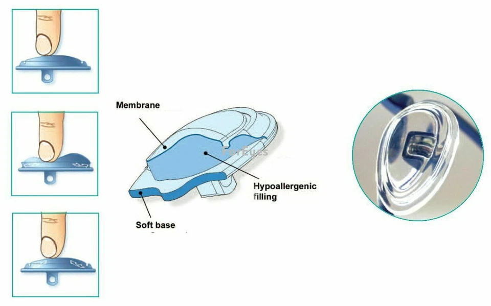 Almohadillas nasales rellenas de gel Biofeel Style ComfyGEL® 14 mm. TIPO EMPUJE Y TORNILLO Disponible Foto 2 de 3