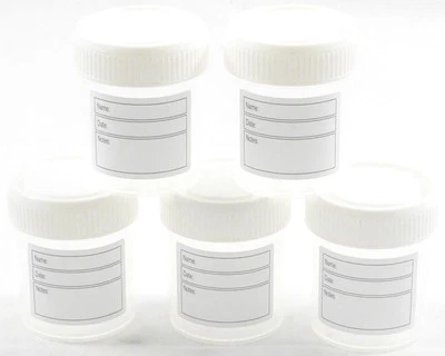 SURE HEALTH & BEAUTY Specimen Container Jars 60ml with Patient Label and Volume Markers per 5