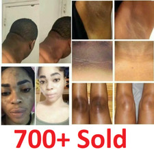 Dark Skin Bleaching Cream Whitening Lightening AHA - Face  Body - 15g