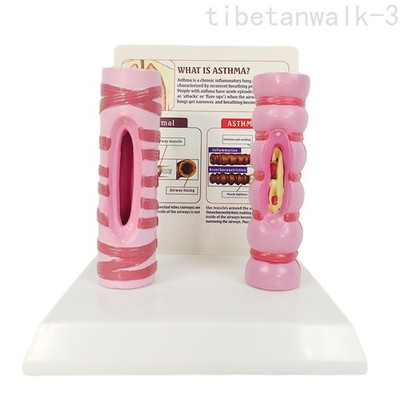 Human Trachea Comparison Model, Organ Anatomy, Respiratory System Structure