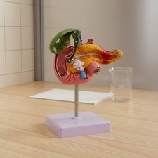 Digestive System Pathology Model Long-Lasting PVC Material for Classroom